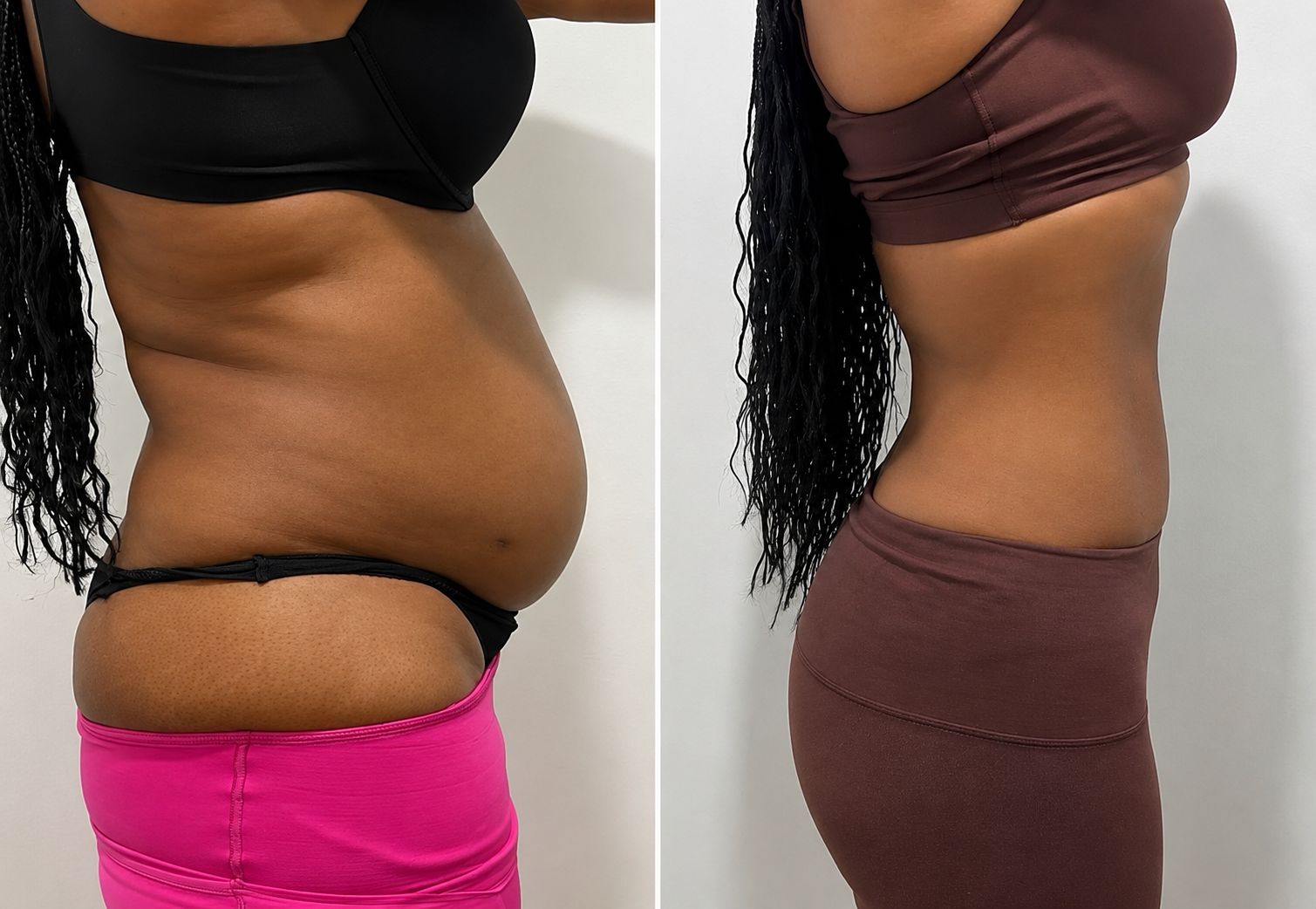 Before and after result 6
