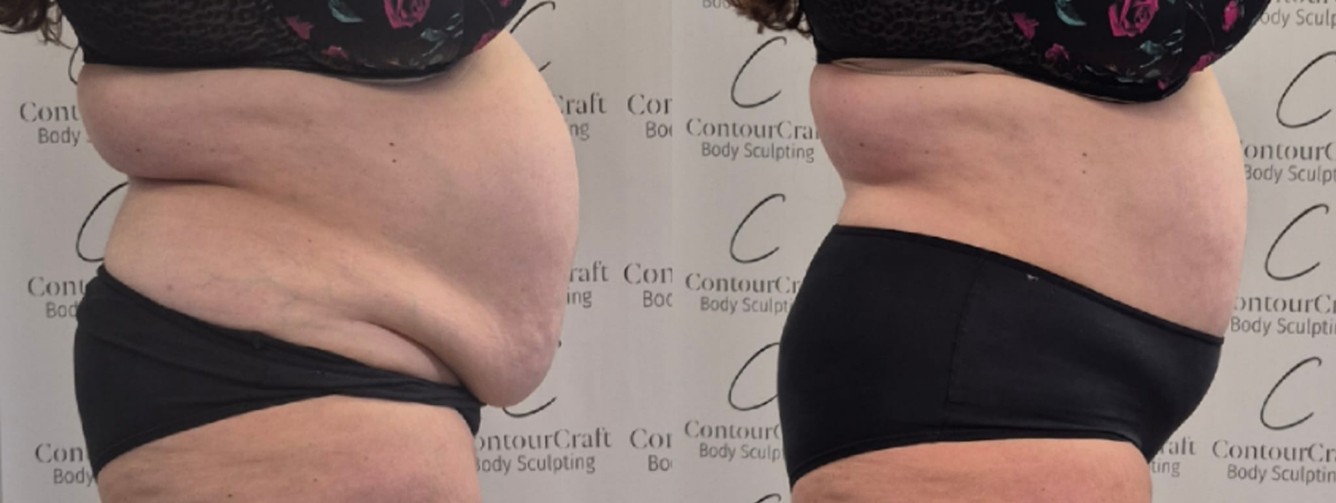 Before and after result 9