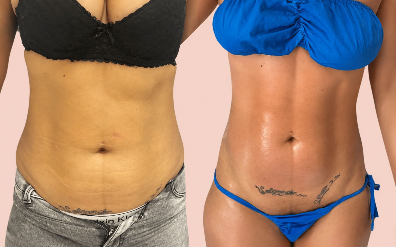 Before and after result 1